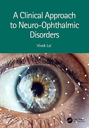 A Clinical Approach to Neuro Ophthalmic Disorders